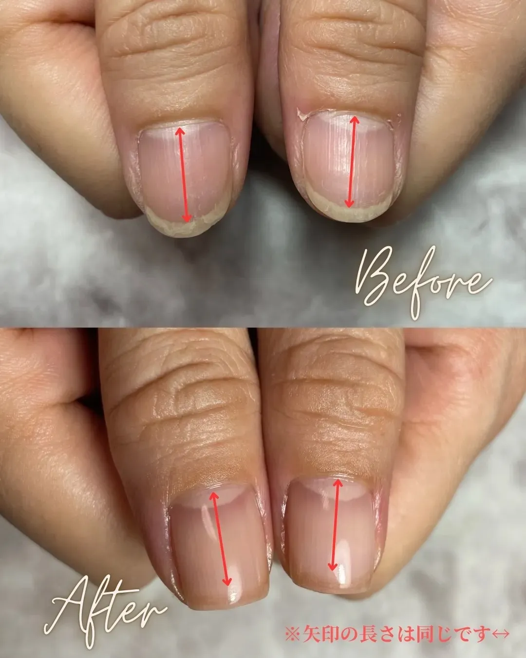 50代K様の施術事例（育成期間3ヶ月）