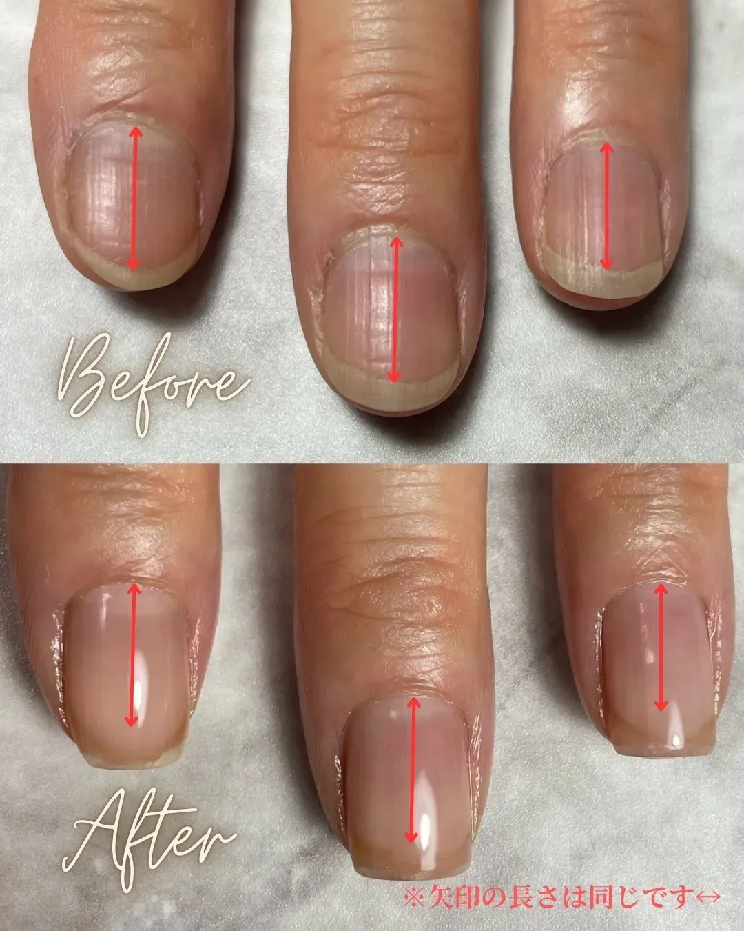 50代N様の施術事例（育成期間1ヶ月）